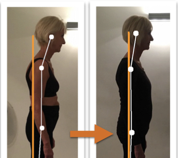 Before and after photos showing improvement of a woman's posture from side view after Egoscue Method