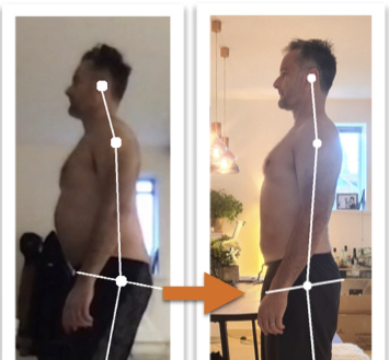 Before and after photos showing remarkable improvement of a man's body alignment from side view after posture correction therapy