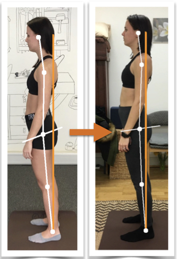 Before and after photos showing good improvement of a woman's body alignment from side view after posture correction therapy