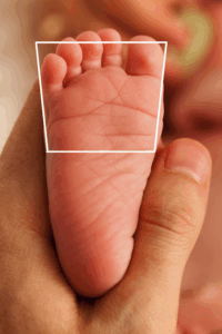 Baby’s foot showing natural toe splay and foot shape without shoe interference